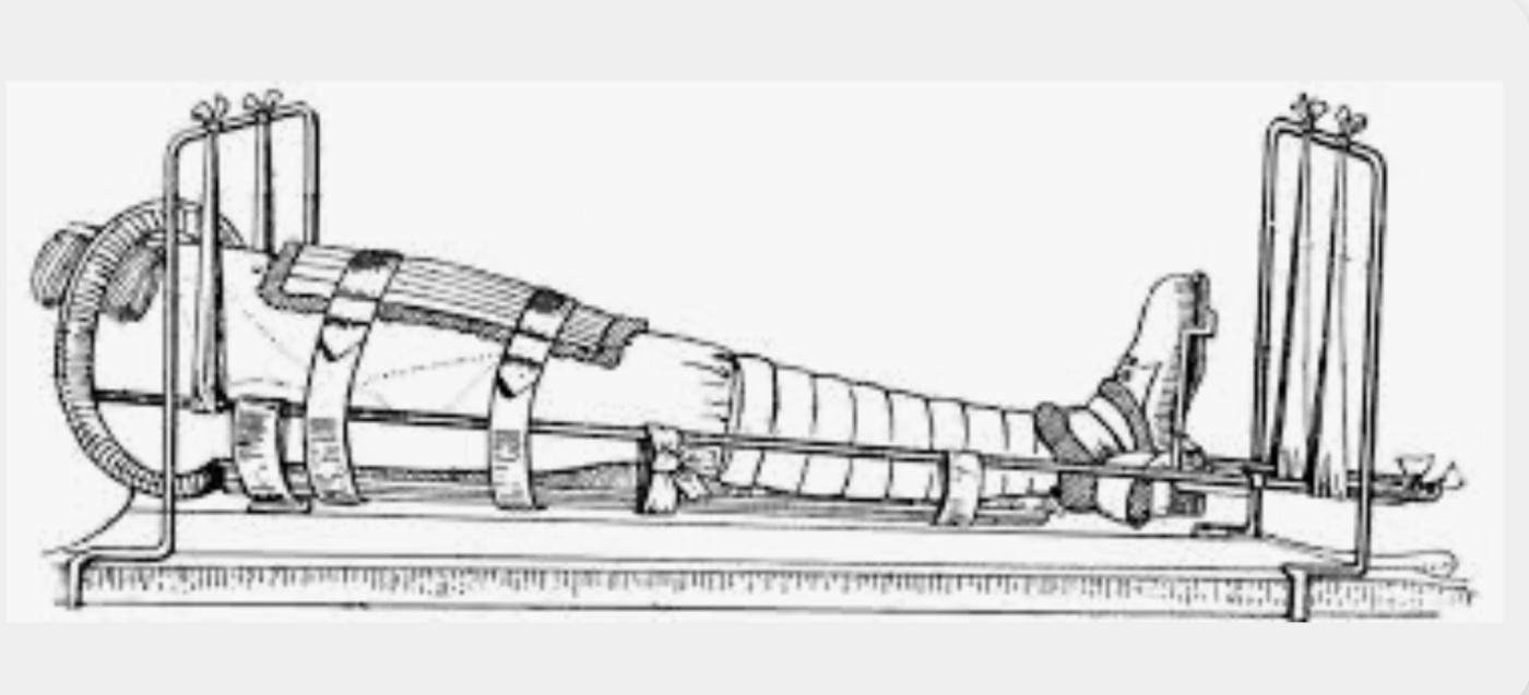 Thomas splint military medical treatment 