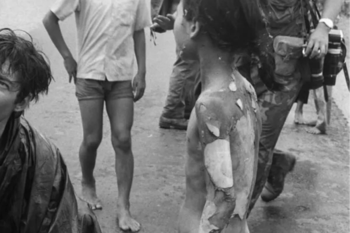 Napalm victims 